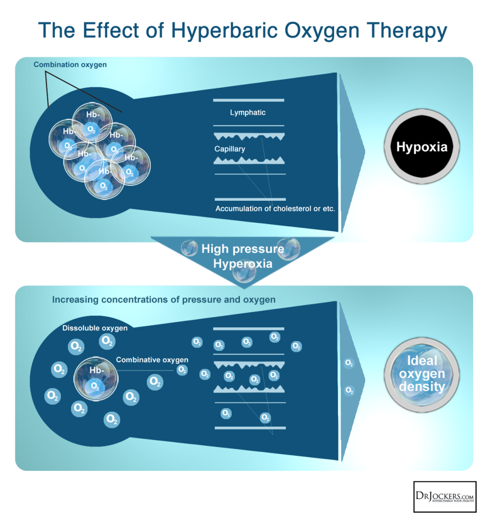 The Health Benefits of HyperBaric Oxygen