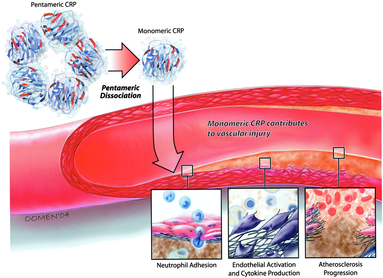 crp-blood-test-c-reactive-protein-normal-range-elevated