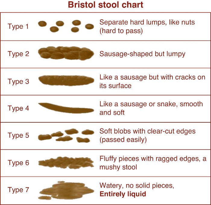 Type 7 Stools