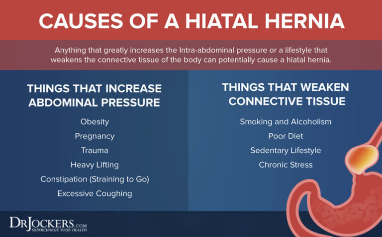 Hiatal Hernia Symptoms Causes And Natural Support Strategies