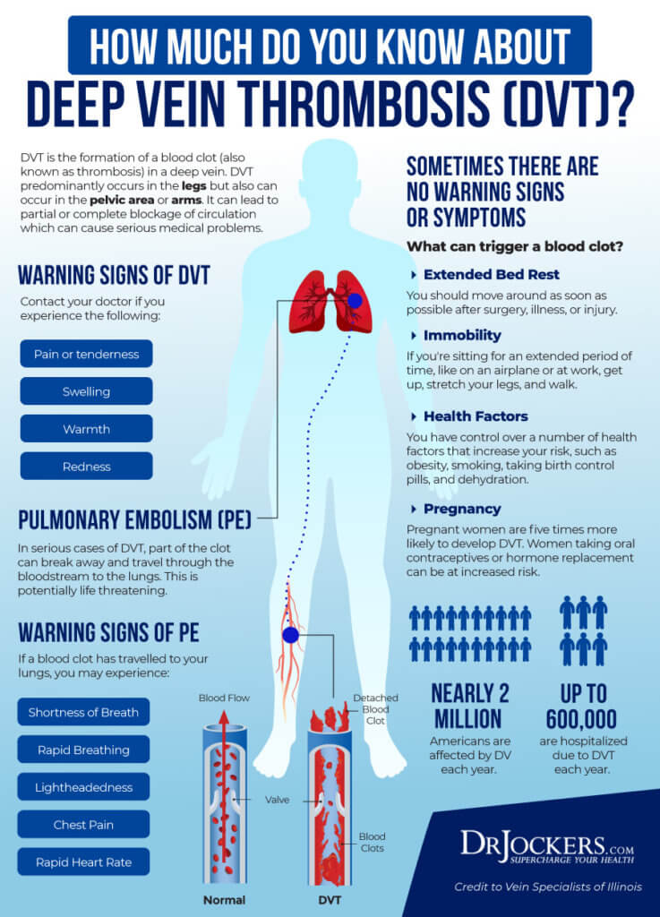 Deep Vein Thrombosis Causes Symptoms And Support Strategies