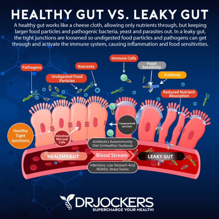 Leptin Resistance Symptoms Causes And Support Strategies