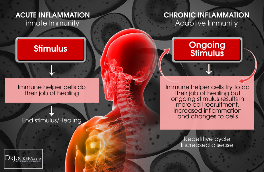 5 Ways To Reduce Inflammation Quickly 3480