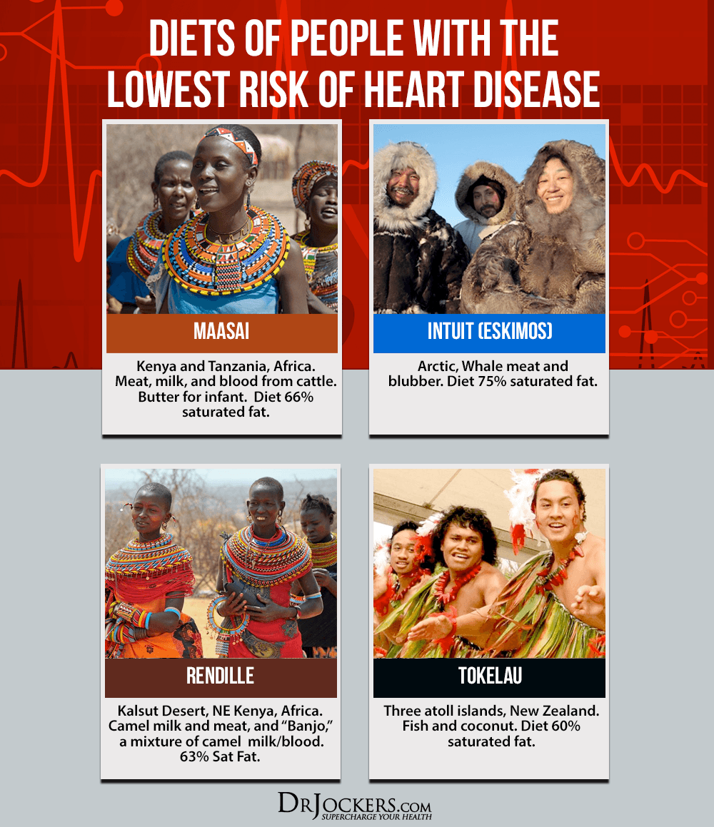 heart disease, Heart Disease:  Major Causes and Natural Support Strategies