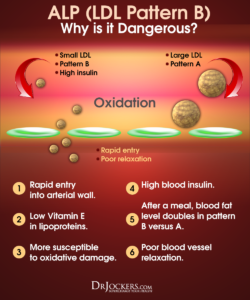 Heart Disease: Major Causes And Natural Support Strategies