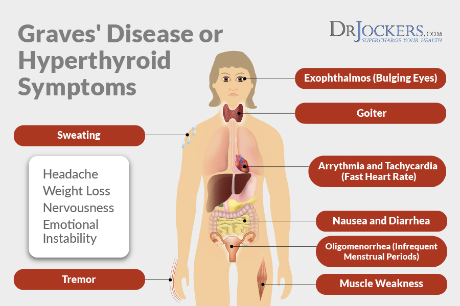 hyperthyroidism, Hyperthyroidism: Symptoms, Causes and Natural Support Strategies