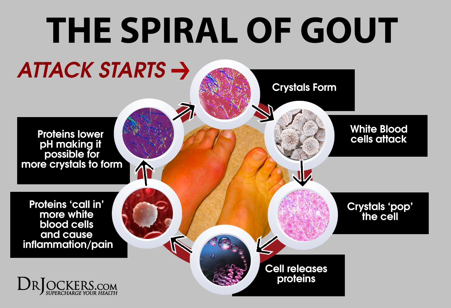 Beat Gout Naturally - DrJockers.com blood pathway diagram 