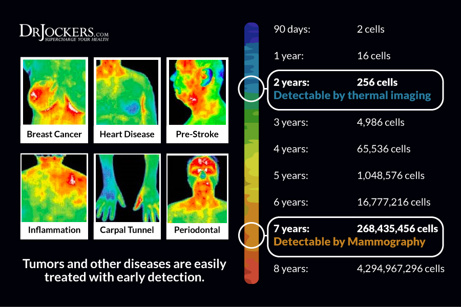 thermography