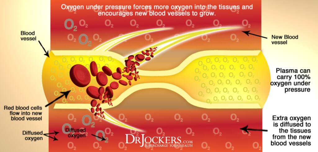hyperbaric oxygen, The Health Benefits of HyperBaric Oxygen Therapy