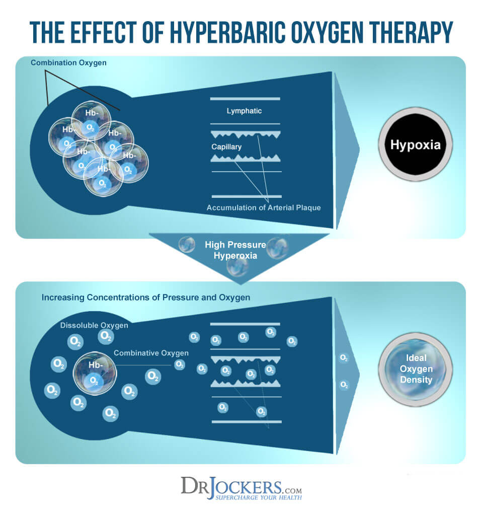 hyperbaric oxygen, The Health Benefits of HyperBaric Oxygen Therapy