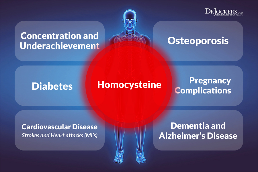 Homocysteine levels, What are Your Homocysteine Levels?