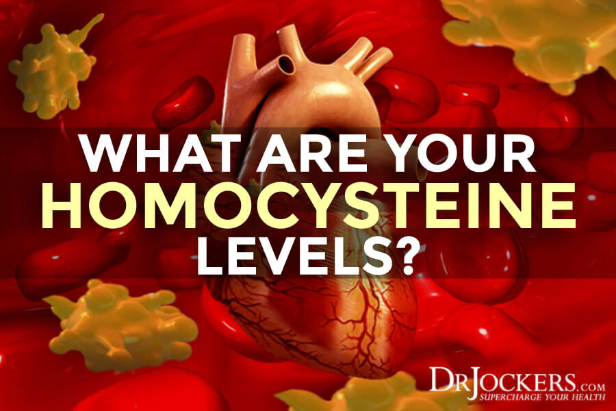 Homocysteine levels, What are Your Homocysteine Levels?