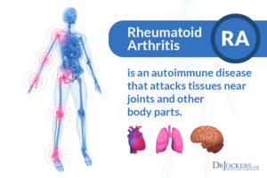 Rheumatoid Arthritis: Symptoms, Causes and Support Strategies