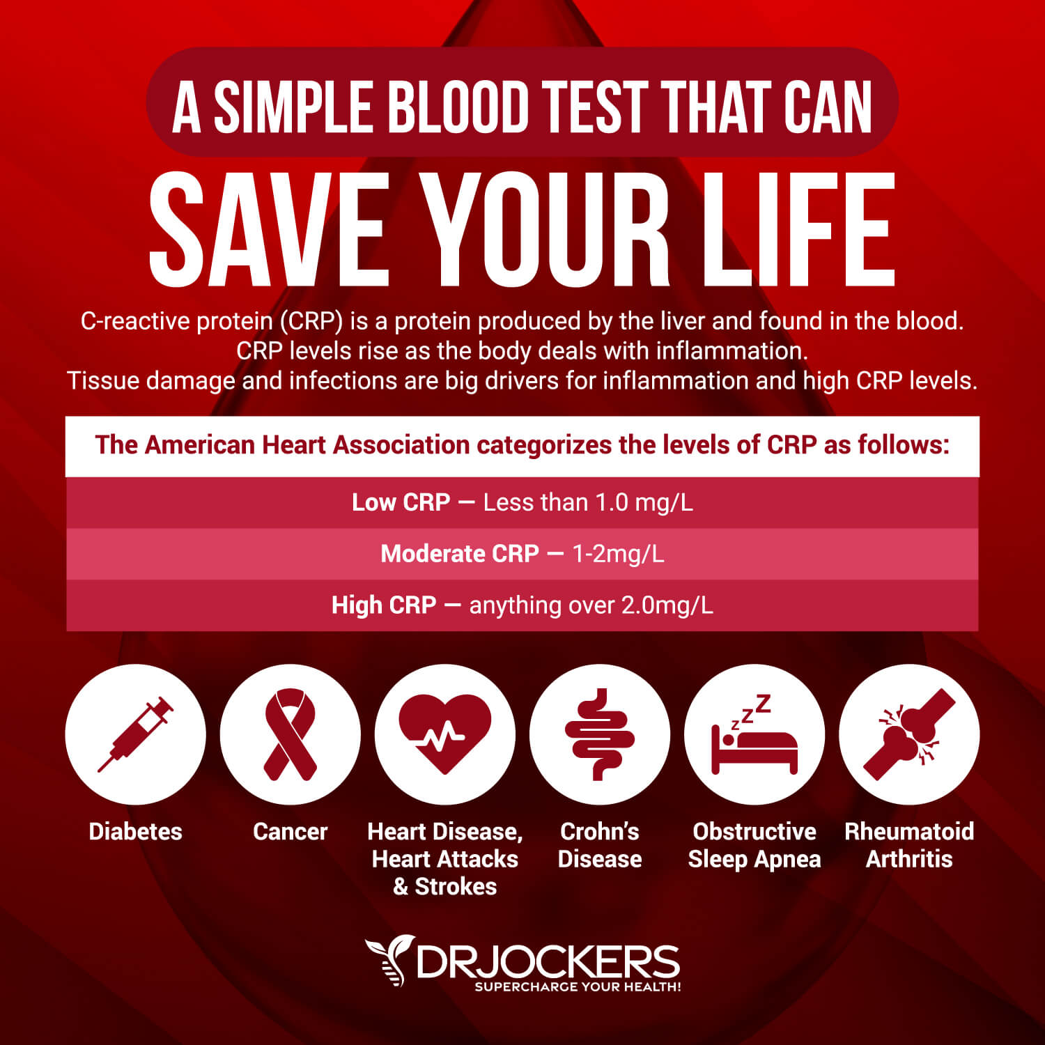 deep vein thrombosis