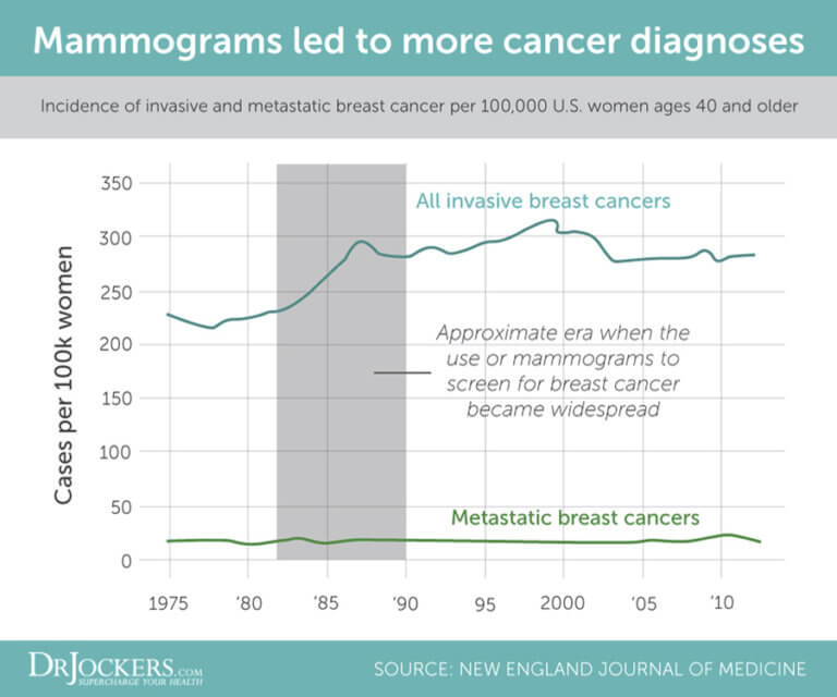 Mammograms and Your Risk of Cancer - DrJockers.com