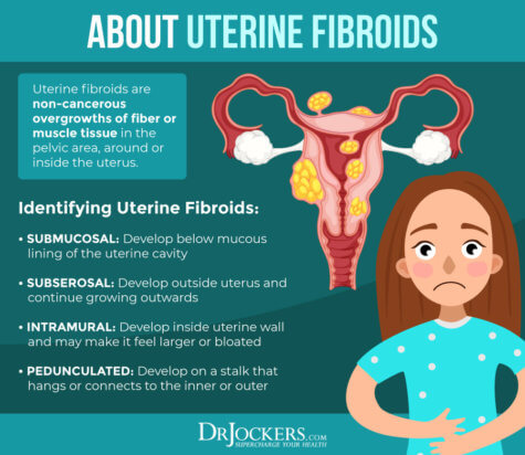 Uterine Fibroids: Symptoms, Causes and Natural Strategies