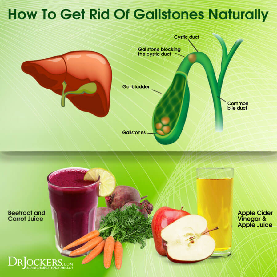 How To Get Rid Of Gallbladder Sludge - Deepcontrol3