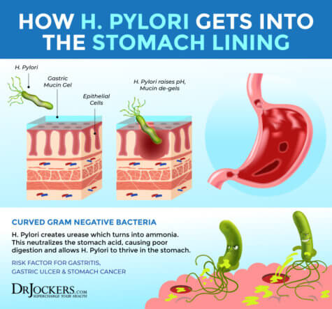 The Damaging Effects of H Pylori Infections - DrJockers.com