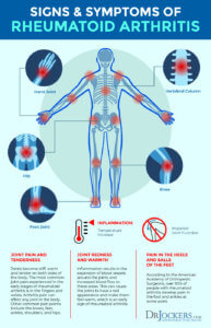 Rheumatoid Arthritis: Symptoms, Causes and Support Strategies