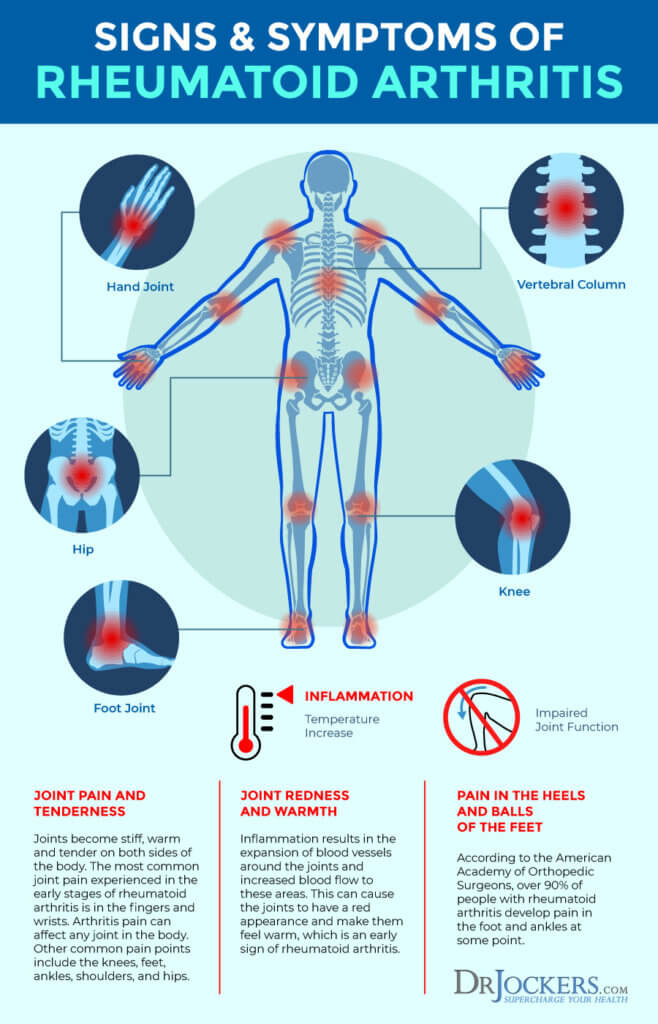 Rheumatoid Arthritis: Symptoms, Causes and Support Strategies