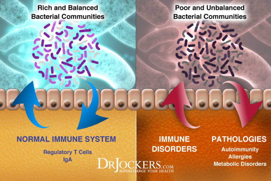 Dysbiosis, Dysbiosis: What is It and How to Heal Your Microbiome 