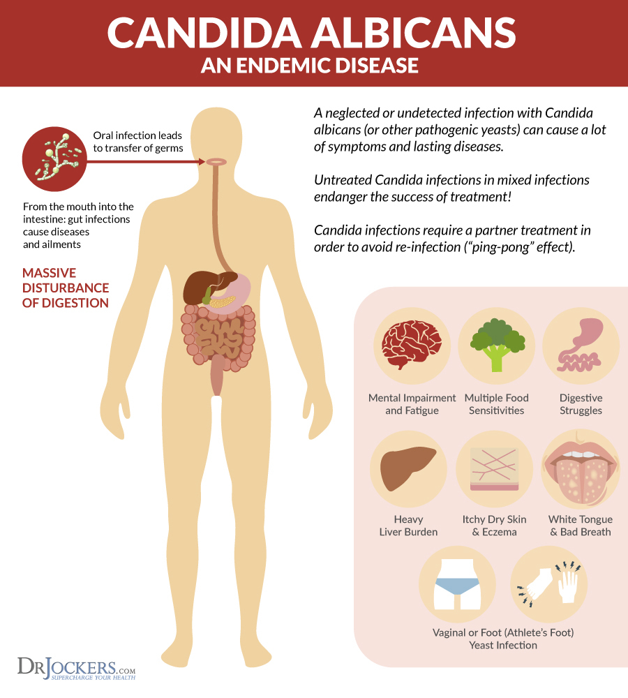 candida albicans, Candida Albicans: Top 10 Herbs and Supplements to Beat it