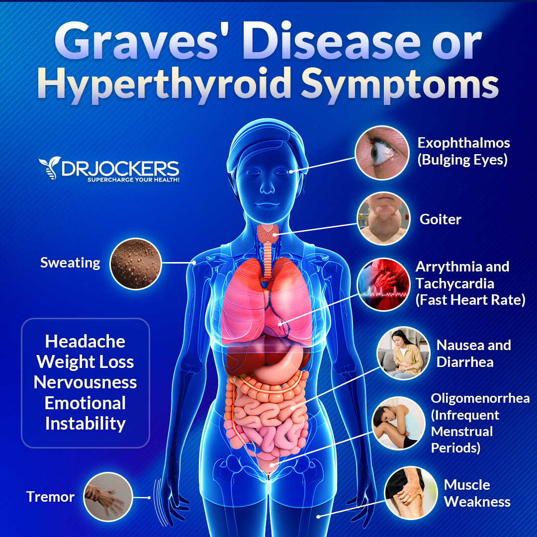 hyperthyroidism