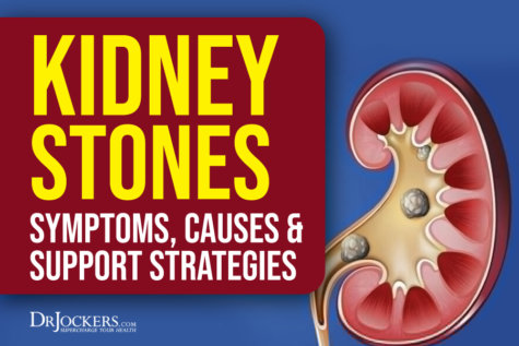 Kidney Stones: Symptoms, Causes and Support Strategies