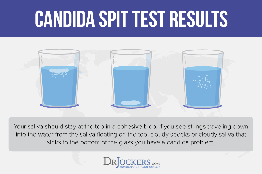 Candida Overgrowth, Candida Overgrowth: Best Home &#038; Lab Tests