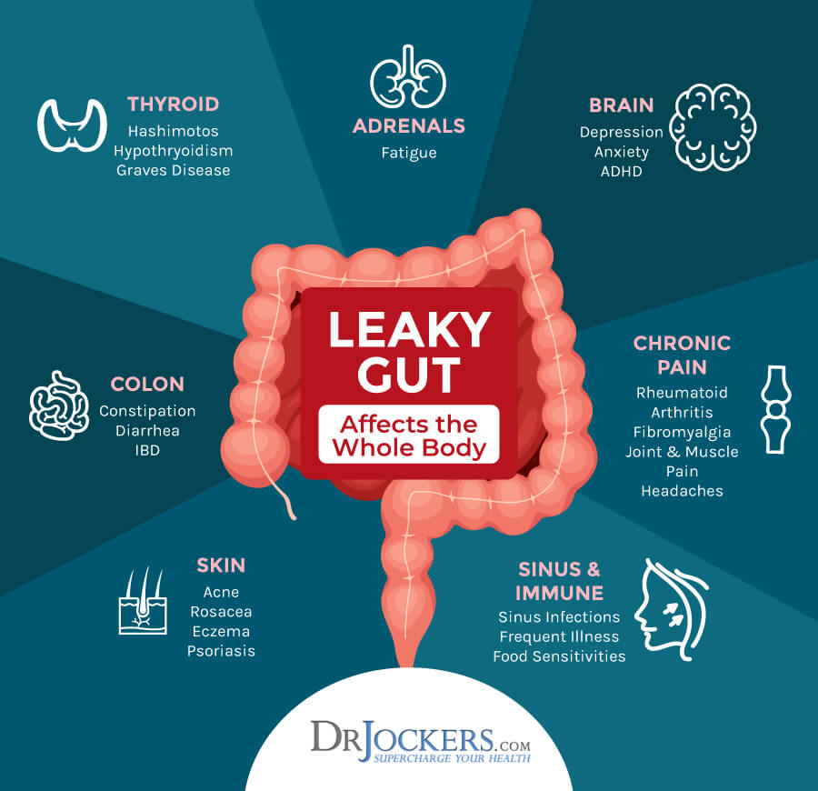 Top 12 Nutrients And Herbs To Heal A Leaky Gut Lining DrJockers