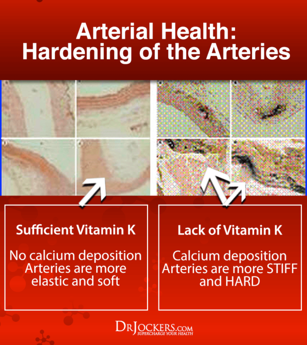 3 Major Benefits of Vitamin K2 For Your Heart and Bones