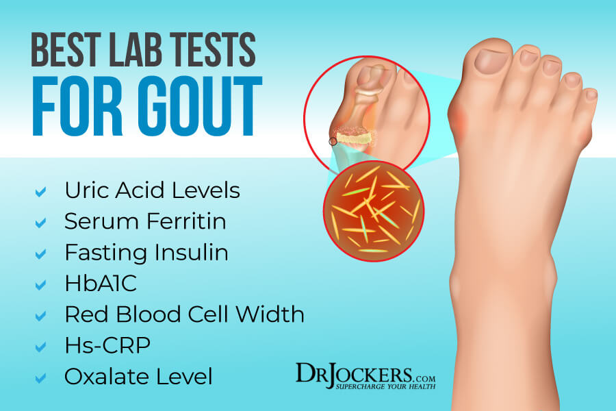 Gout, Gout:  Symptoms, Causes and Natural Support Strategies