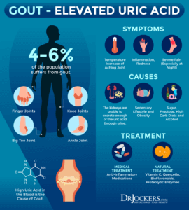 Gout: Symptoms, Causes and Natural Support Strategies