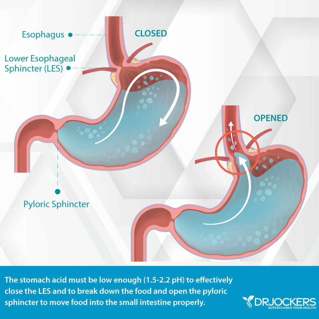 Acid Reflux Treatment in Mission Viejo - Colorectal and Gastro Clinic |  Colon Cancer | Colonoscopy | Endoscopy | Gallbladder | GERD