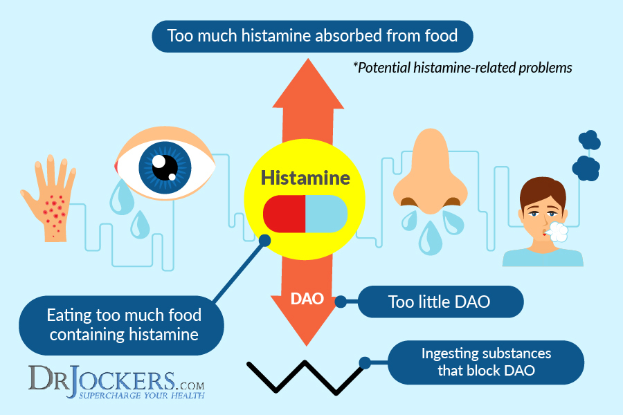 histamine intolerance