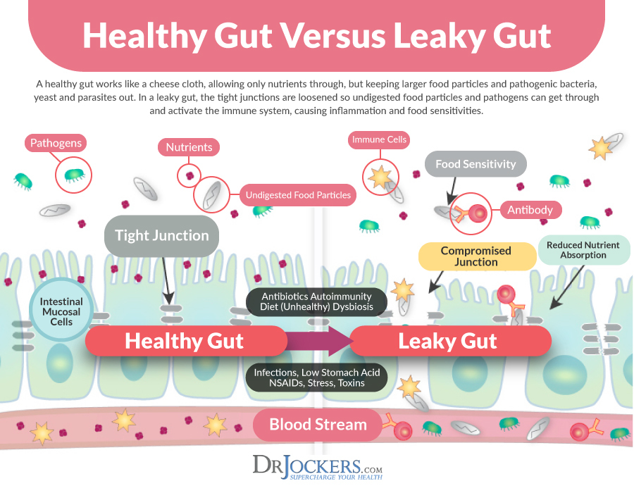 Dysbiosis, Dysbiosis: What is It and How to Heal Your Microbiome 