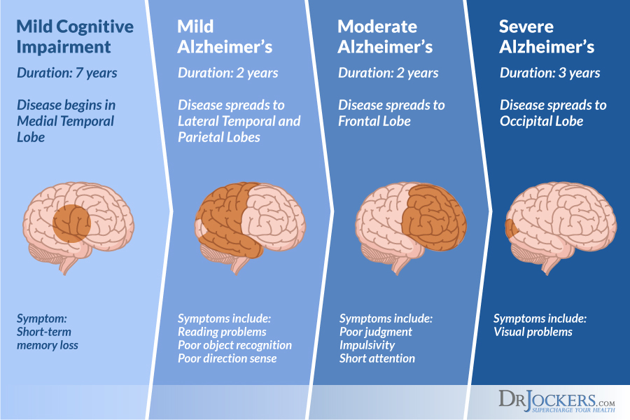 Dementia, Dementia: Symptoms, Causes &#038; Natural Support Strategies