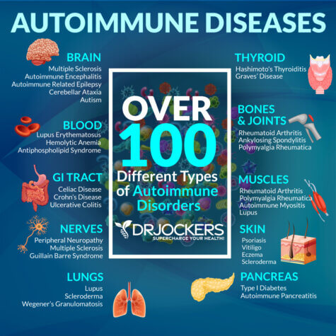 The 7 Major Factors Causing Autoimmune Conditions