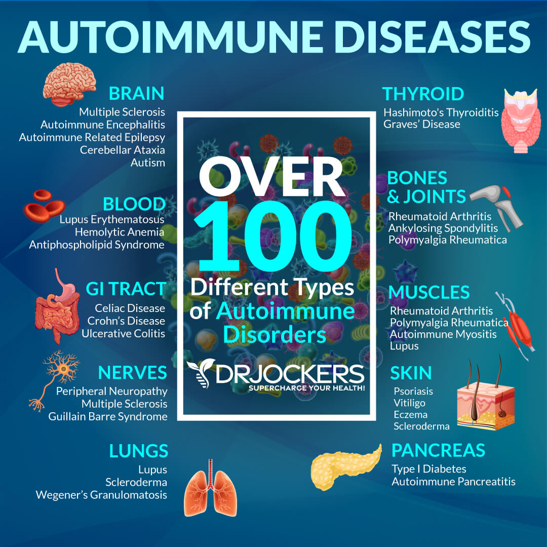 The 7 Major Factors Causing AutoImmune Conditions 