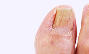 10 Nail Problems You Need to Know About 