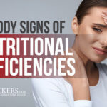 Nutritional Deficiencies, 5 Body Signs of Nutritional Deficiencies
