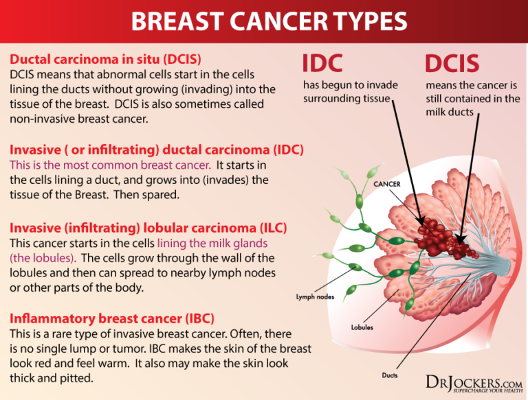 Breast Cancer Causes, Symptoms and Natural Support Strategies