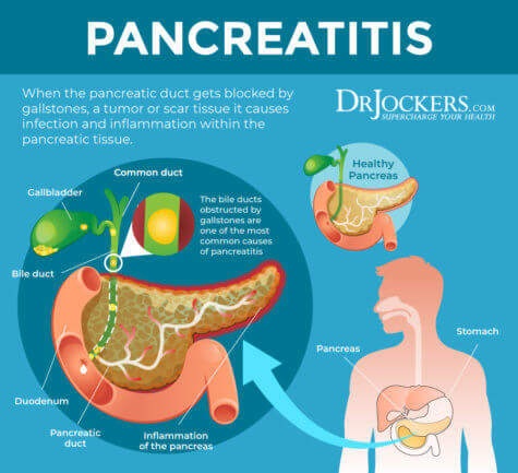 Pancreatitis: Symptoms, Causes and Natural Support Strategies