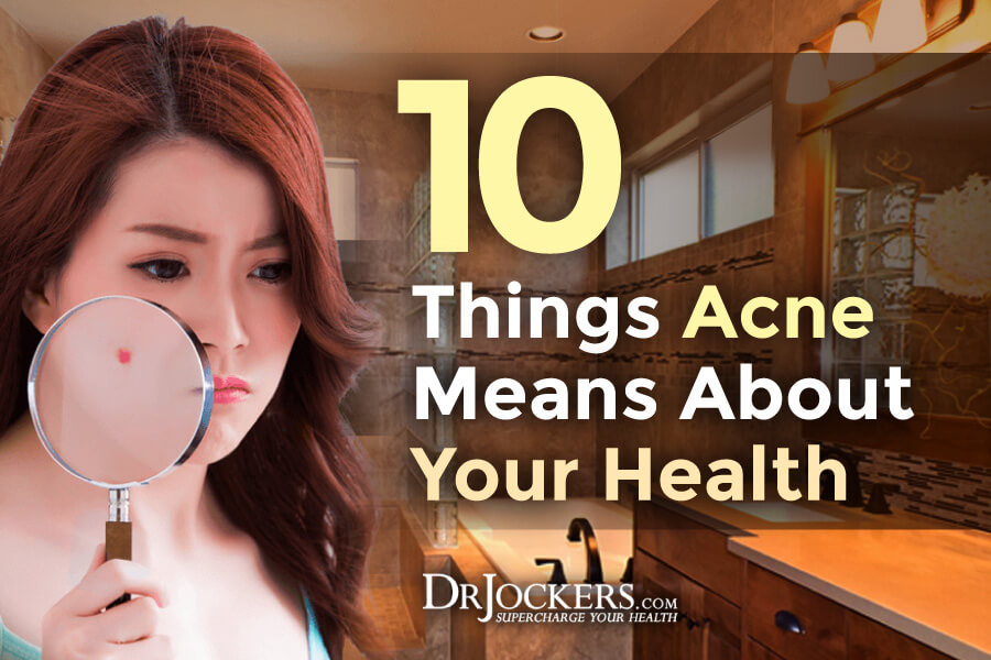 acne, 10 Things Acne Means About Your Health