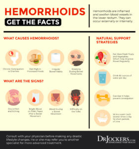 Hemorrhoids: Symptoms, Causes and Natural Support Strateg