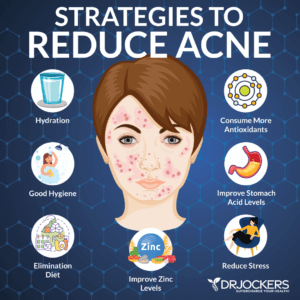 10 Things Acne Means About Your Health - DrJockers.com