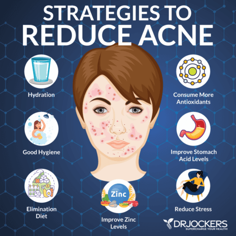 10 Things Acne Means About Your Health - DrJockers.com