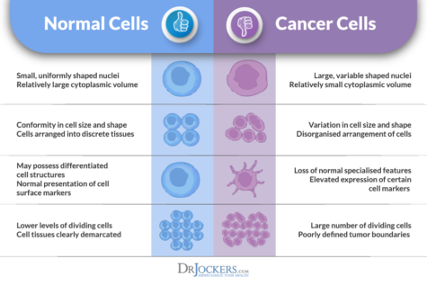 How Does Metastatic Cancer Form in The Body? - DrJockers.com