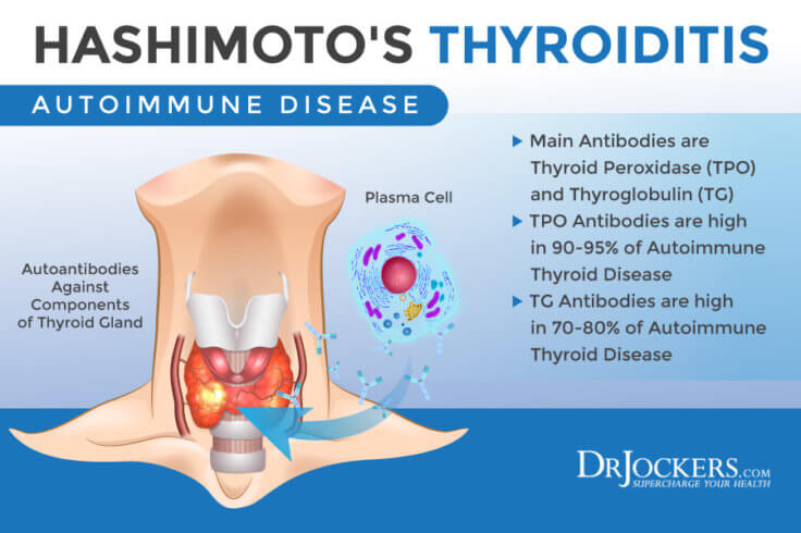 How to Properly Test Thyroid Function with Labs - DrJockers.com
