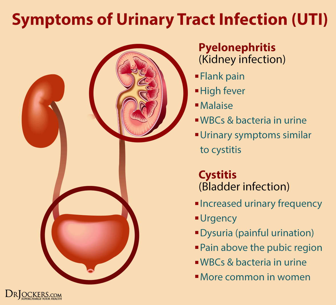 Urinary, 5 Phases to Support Urinary Health Naturally